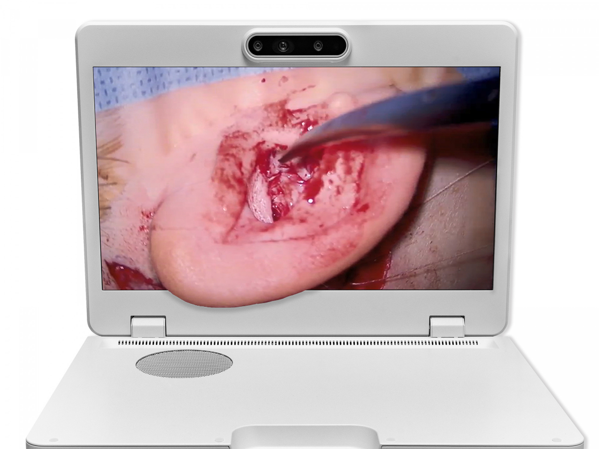 达擎之＂Heads-up 3D显微手术显示系统＂，整合4K裸眼3D显示及眼球追踪系统，具备快速追踪人眼移动位置功能，减轻医师长时间维持固定姿势的负担，让医师能有更宽广清晰的3D立体视野及更舒适的姿势来执行手术。